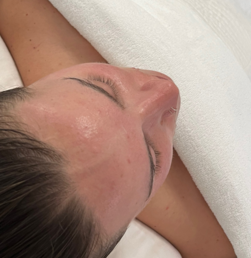 Brighter skin after face massage